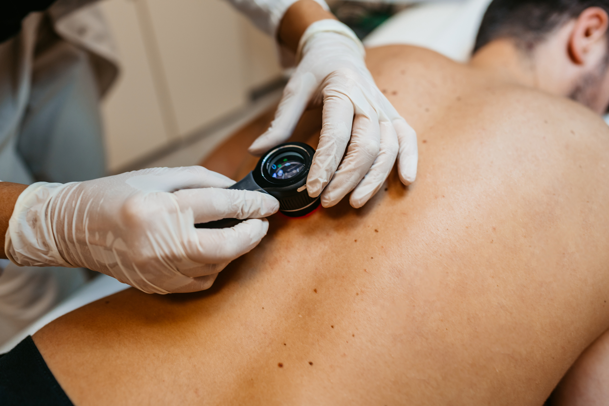 What Does Skin Cancer Look Like?
