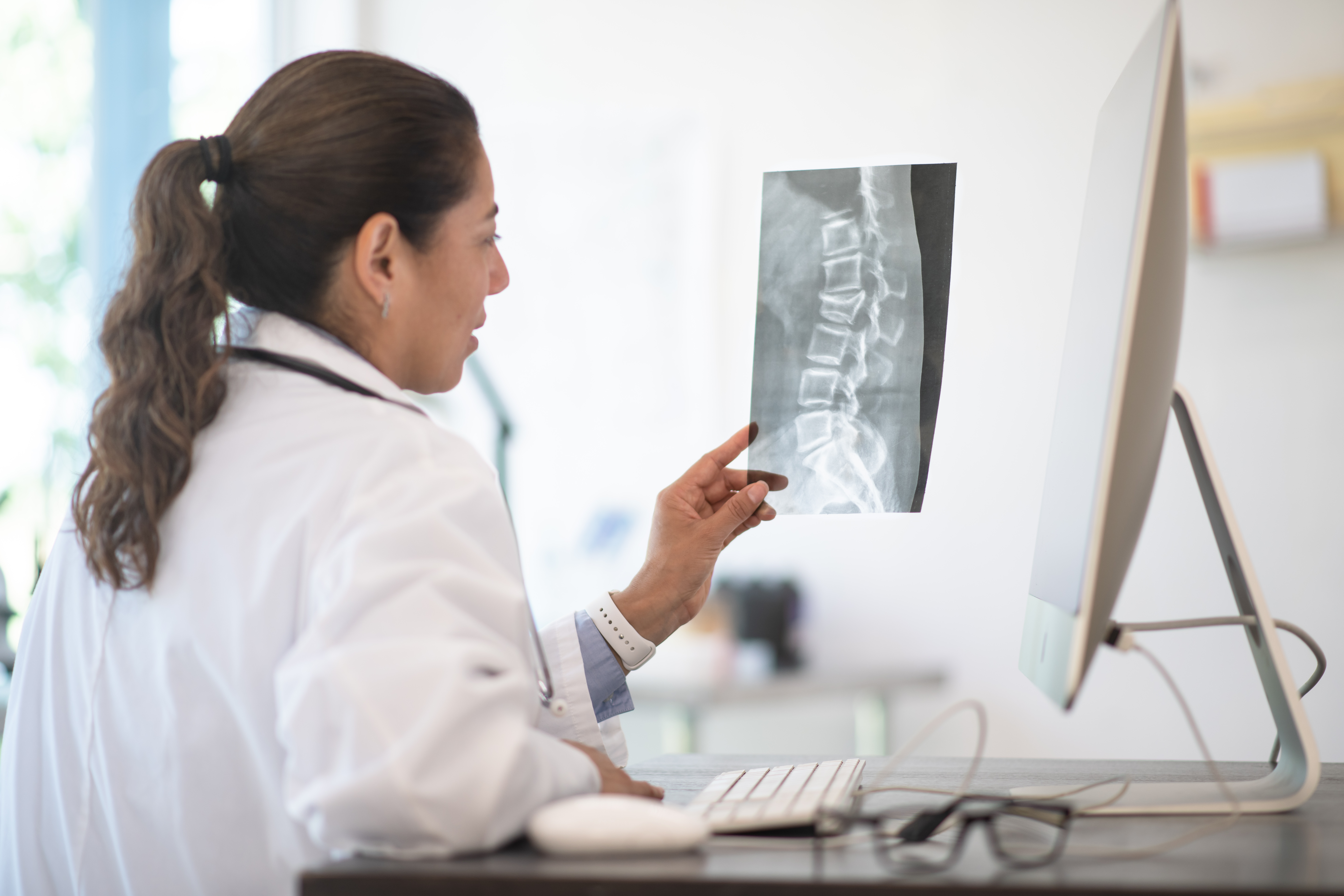 doctor looking at an image of a spine