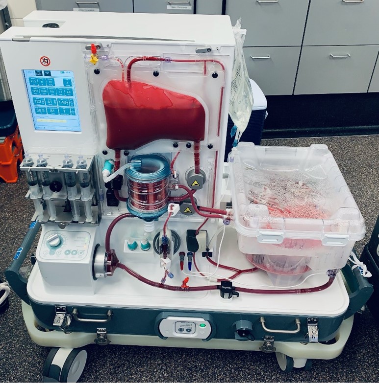 Liver Transplant INTEGRIS