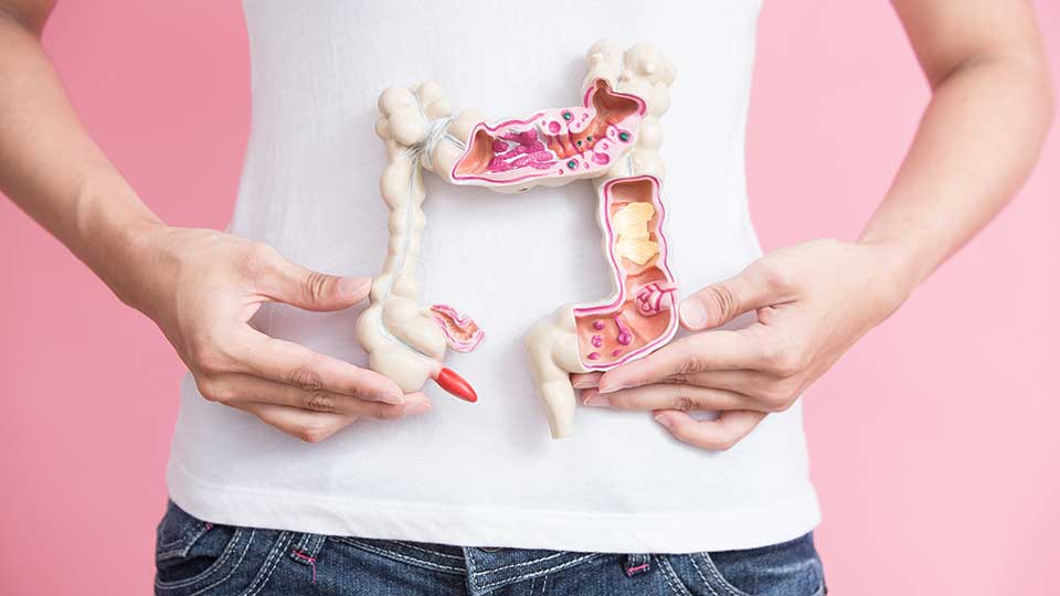 woman with colorectal cancer