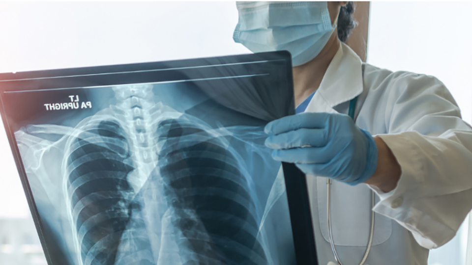 Ion Robotic Lung Biopsy System Now Offered at INTEGRIS Health Southwest Medical Center