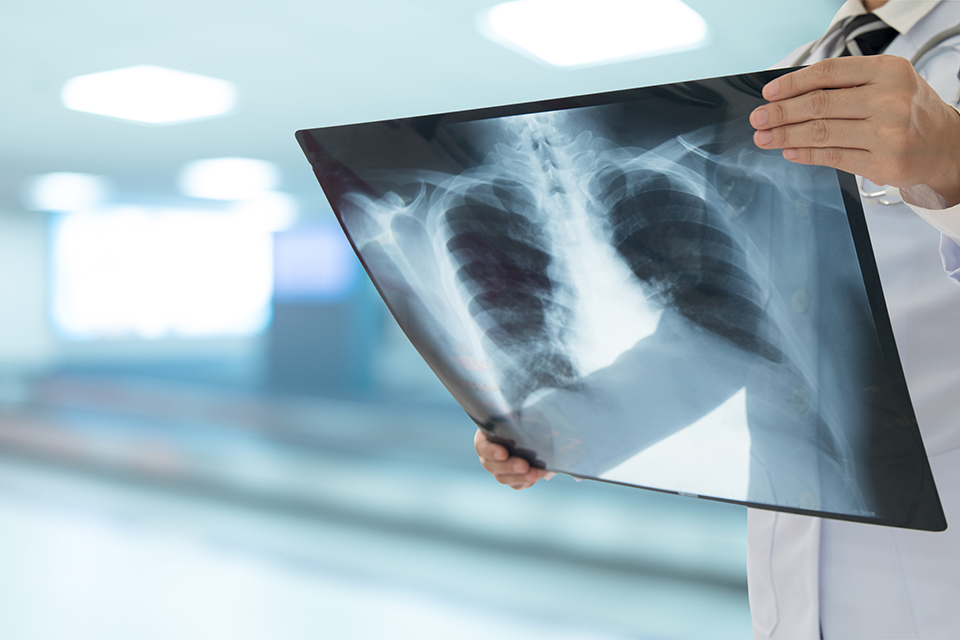 INTEGRIS Health Recognizes Lung Cancer Awareness Month