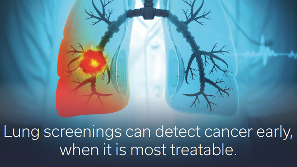 Lung Cancer Screenings Save Lives