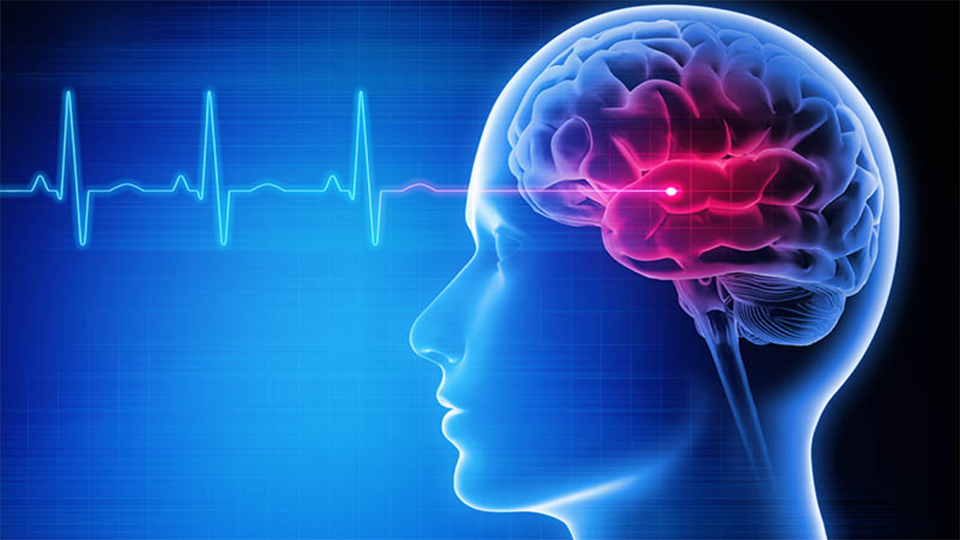 Stroke is the No. 5 cause of death and a leading cause of disability in the United States. 