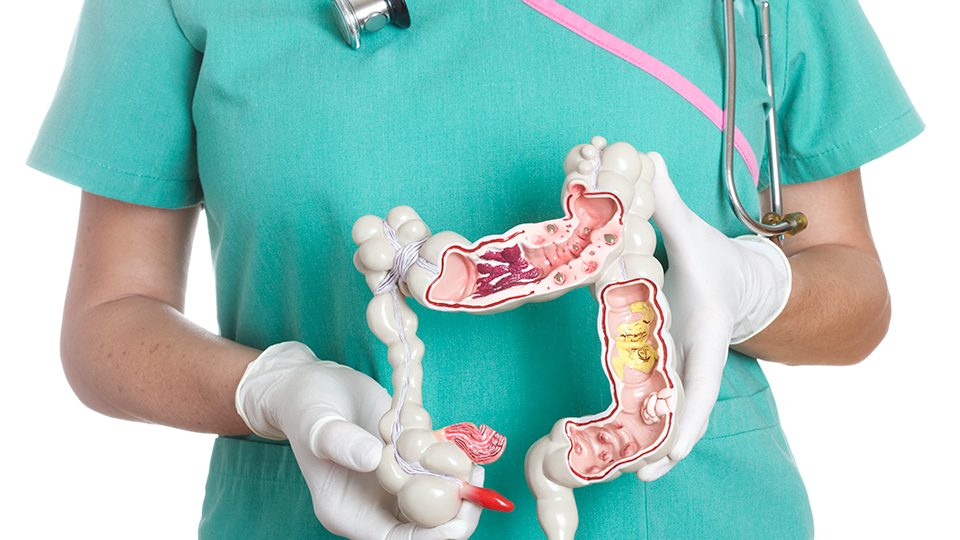 Catching Colon Cancer: Early Symptoms to Look For