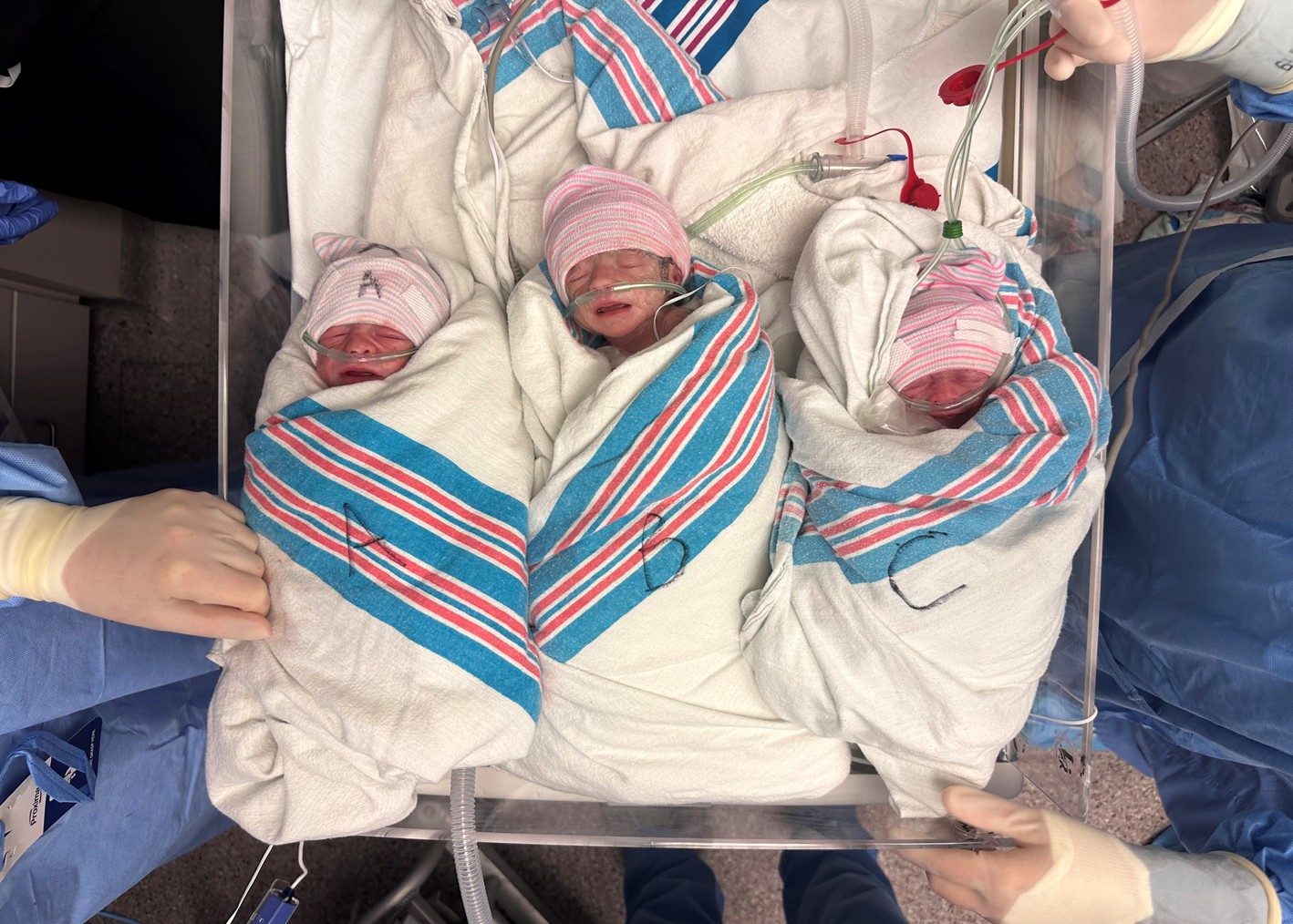 Emergency Triplet Delivery Leads to Life-Saving Care and Cancer Discovery