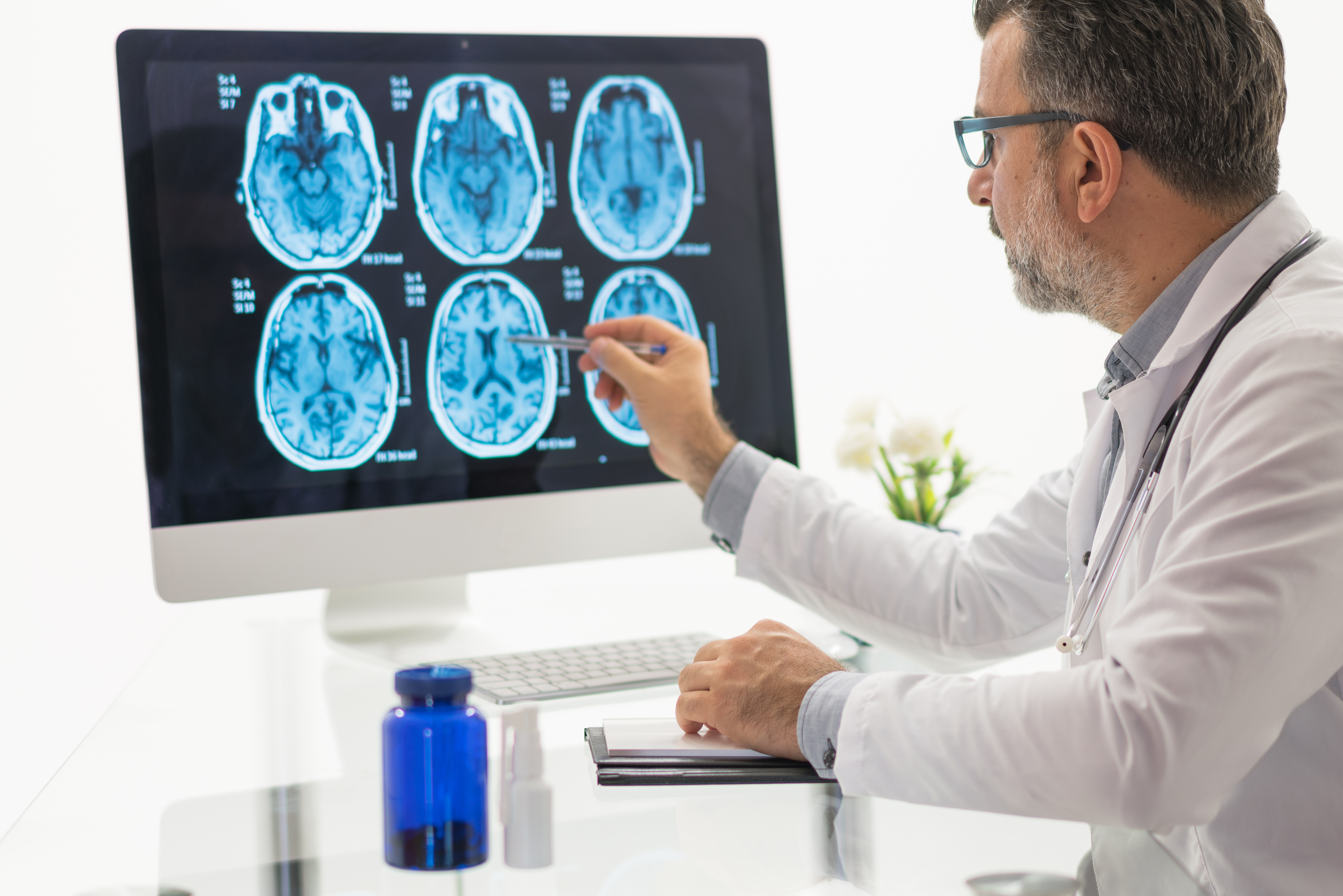 Neurologist looking at a brain scan.