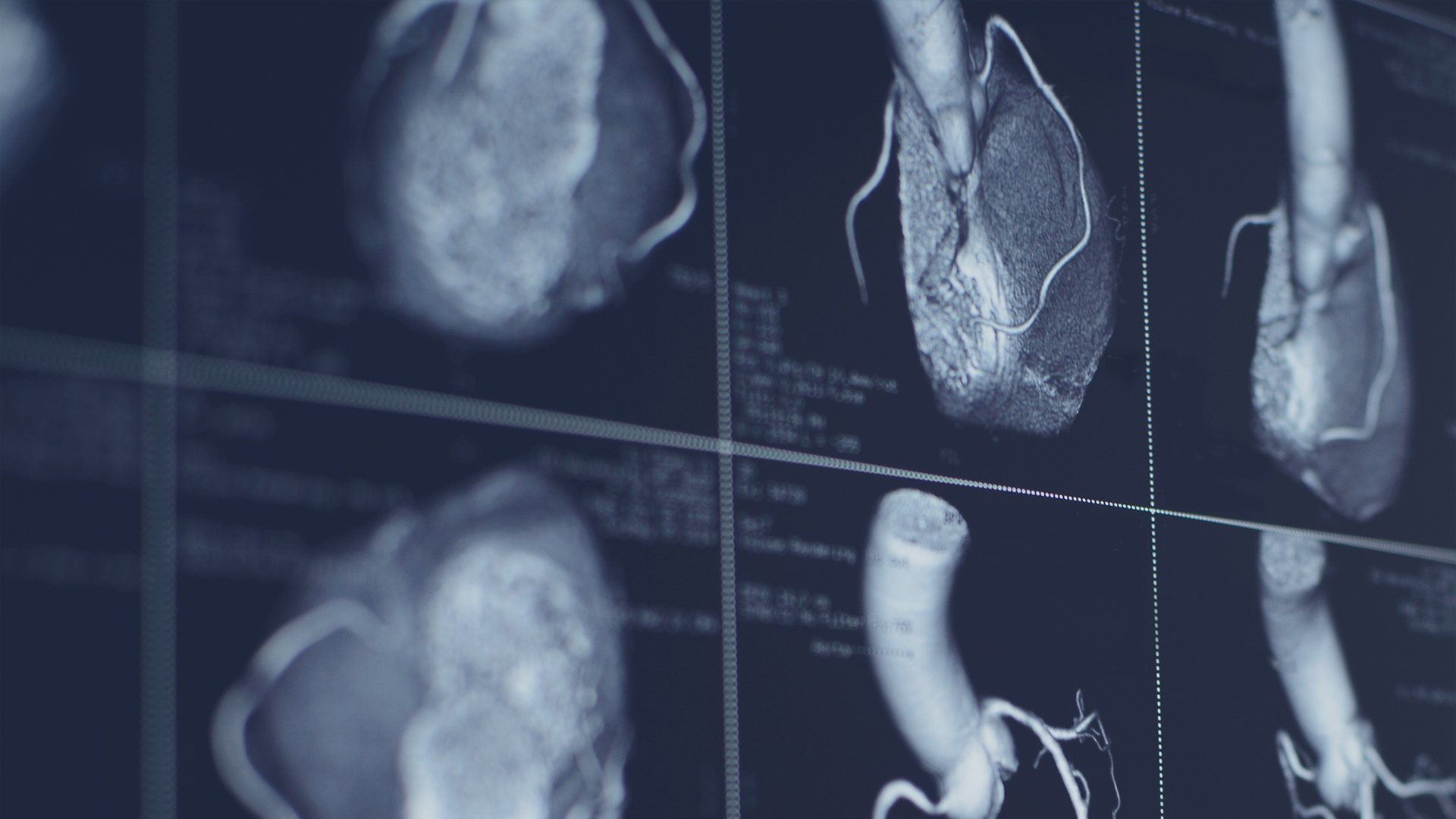 $50 Heart Scan