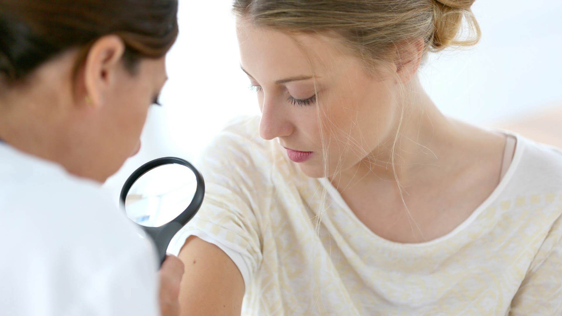 How to Recognize Benign Skin Conditions