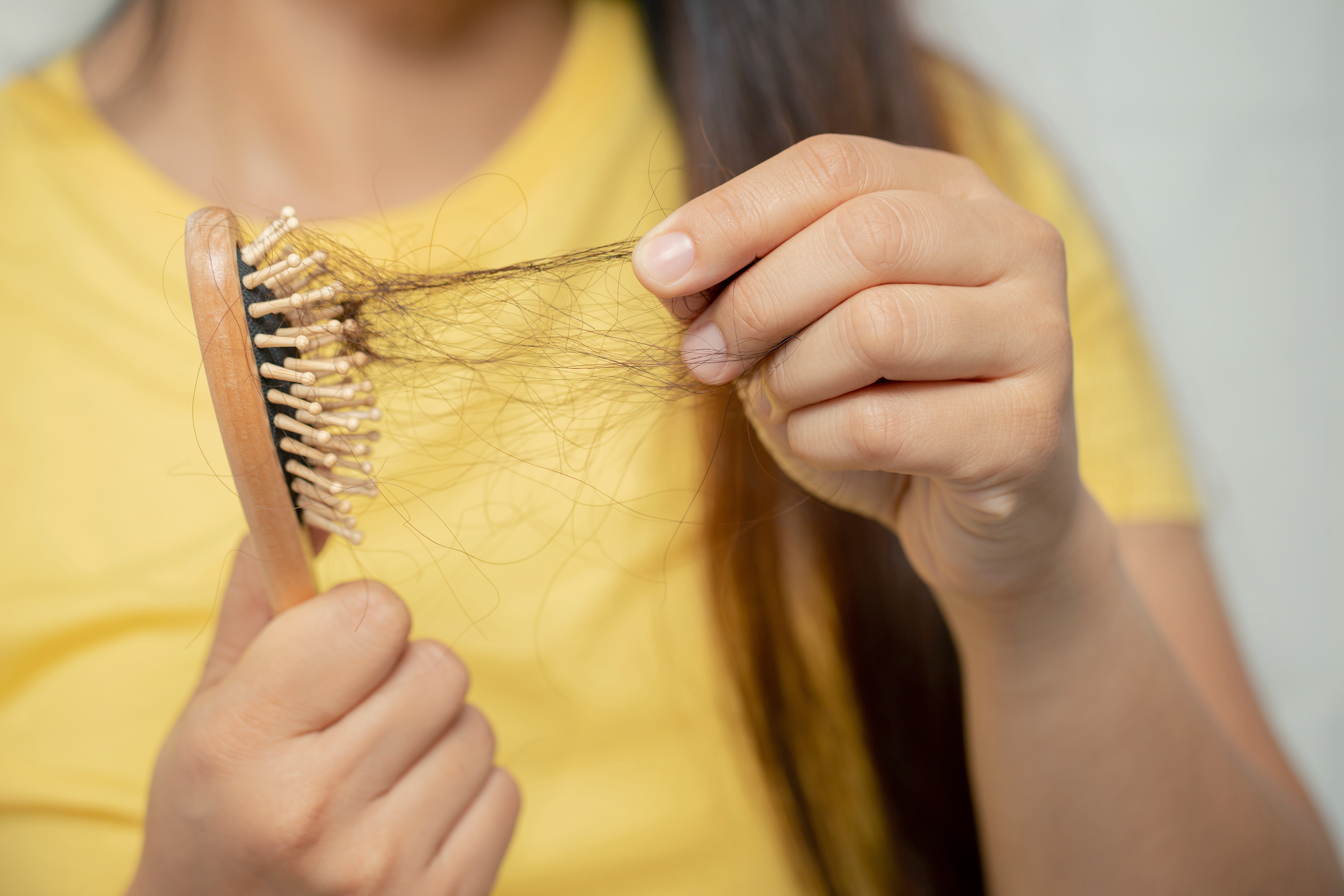 A woman holds a brush filled with hair 