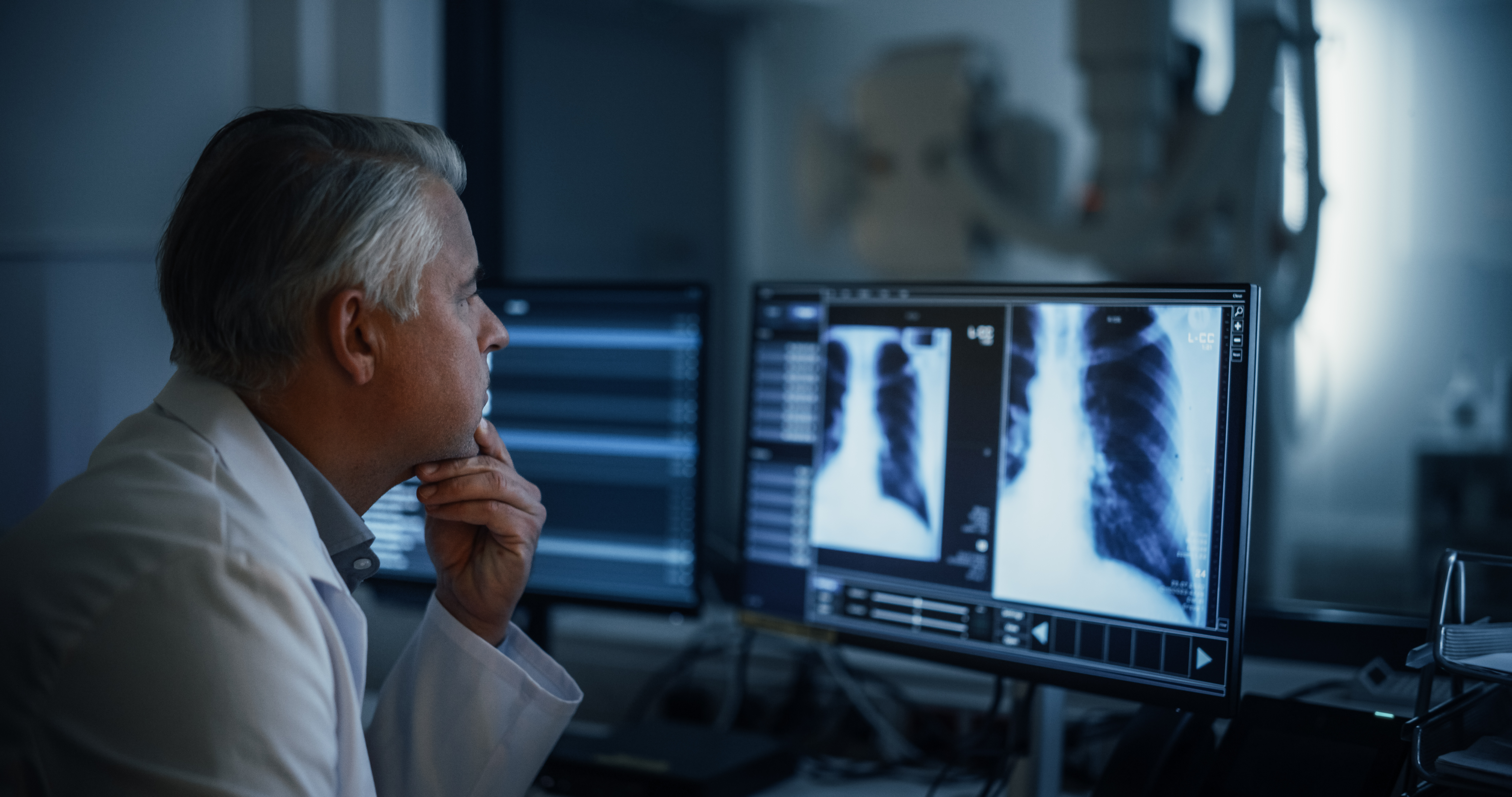 A doctor looks at a lung imaging scan