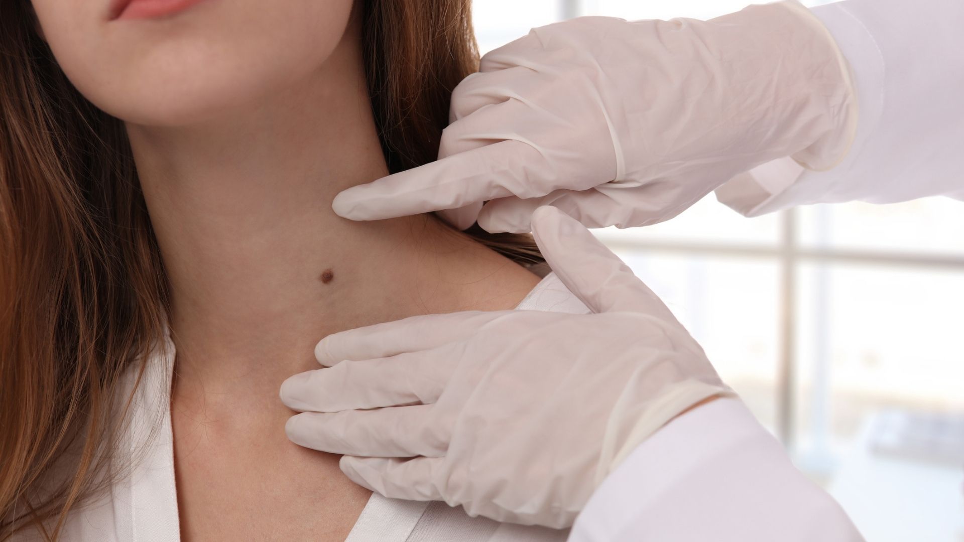 When to get a mole looked at