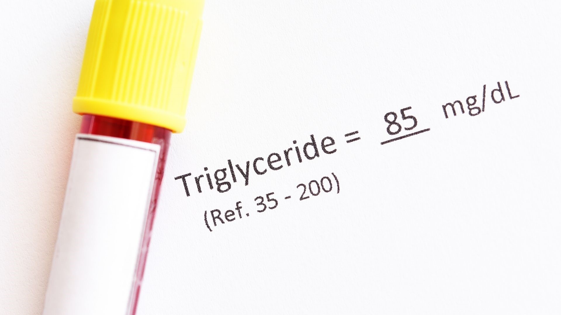 chart of triglycerides